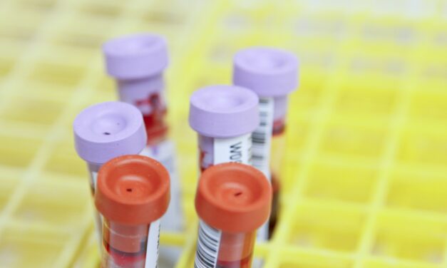 Liver Involvement in Myotubular and Centronuclear Myopathy: Findings of a Registry Study